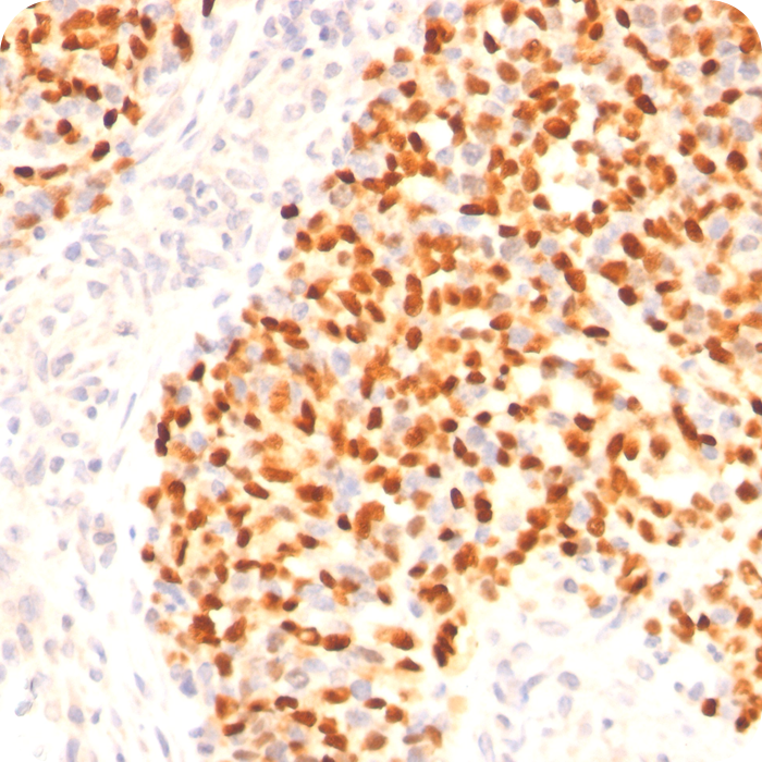 Myogenin (Skeletal Muscle Marker); Clone F5D (Concentrate)