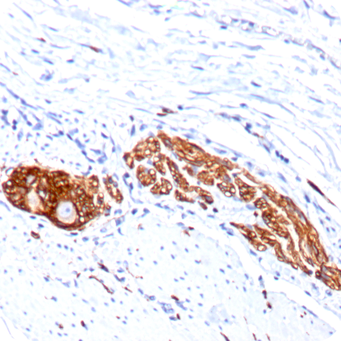 CD56 / NCAM1 / NKH1 (Neuronal Cell Marker); Clone 123A8 (56C04) (Concentrate)