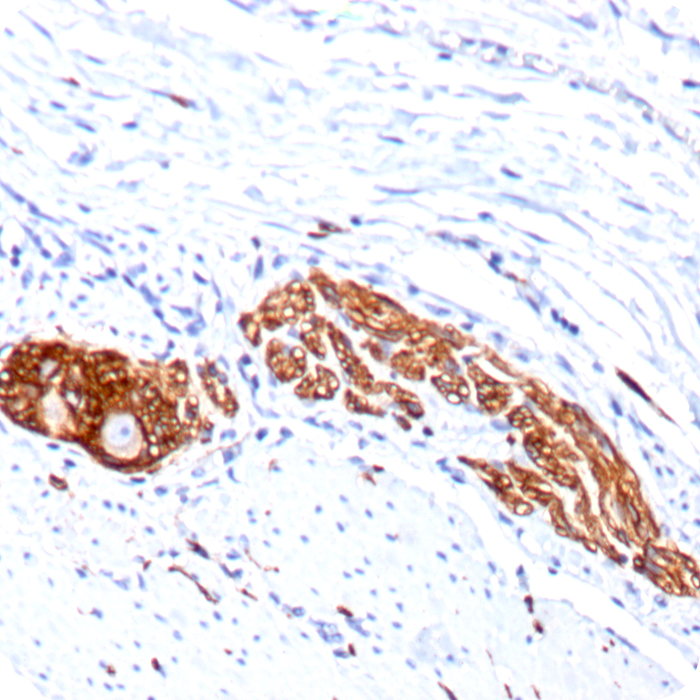 CD56 / NCAM1 / NKH1 (Neuronal Cell Marker); Clone 123C3.D5 & 123A8 (Concentrate)