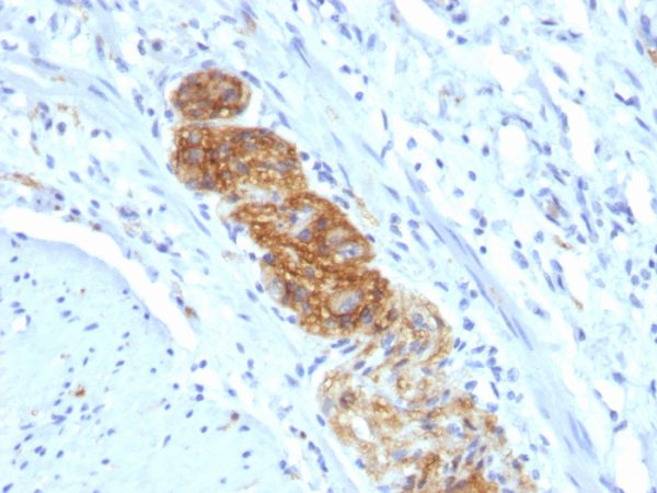 CD56 / NCAM1 / NKH1 (Neuronal Cell Marker); Clone NCAM1/784 (Concentrate)