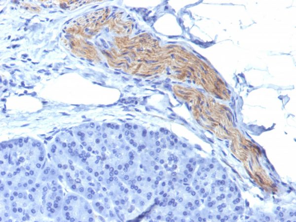 CD56 / NCAM1 / NKH1 (Neuronal Cell Marker); Clone NCAM1/795 (Concentrate)