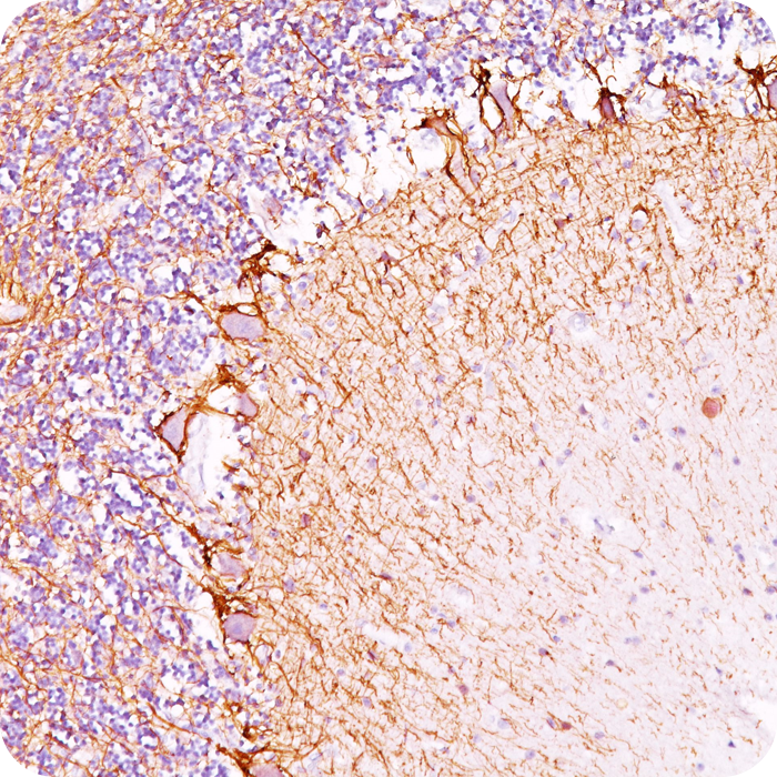 Neurofilament (NF-H) (Neuronal Marker); Clone RT97 (Concentrate)