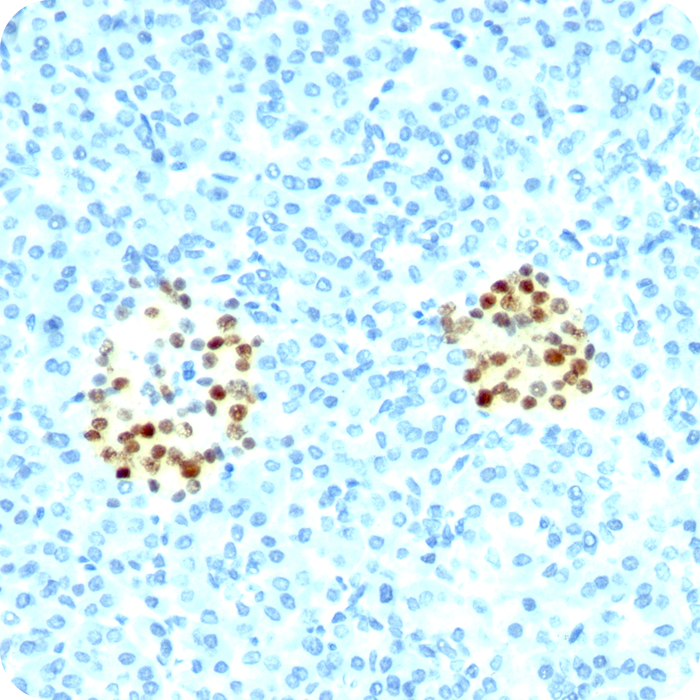 NKX2.2 (Neuroendocrine & Ewing Sarcoma Marker); Clone NX2/294 (Concentrate)