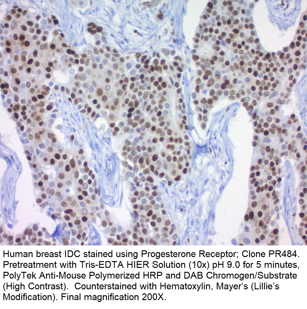 Progesterone Receptor (Marker of Progestin Dependence); Clone PR484 (Concentrate)