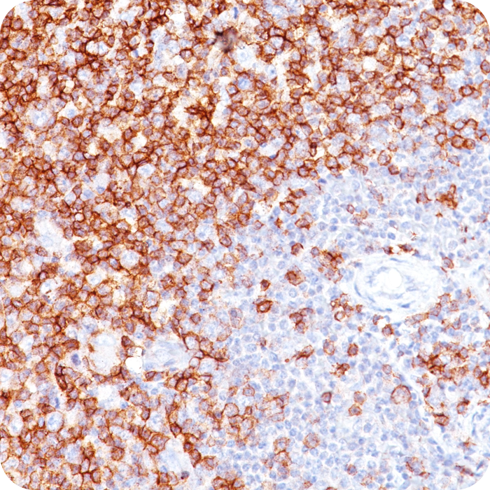 CD45RO (T-Cell Marker); Clone UCHL-1 (Concentrate)