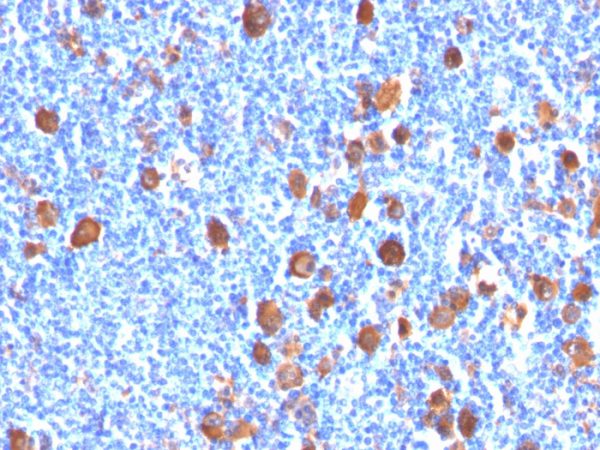Fascin-1; Clone FSCN1/416 (Concentrate)