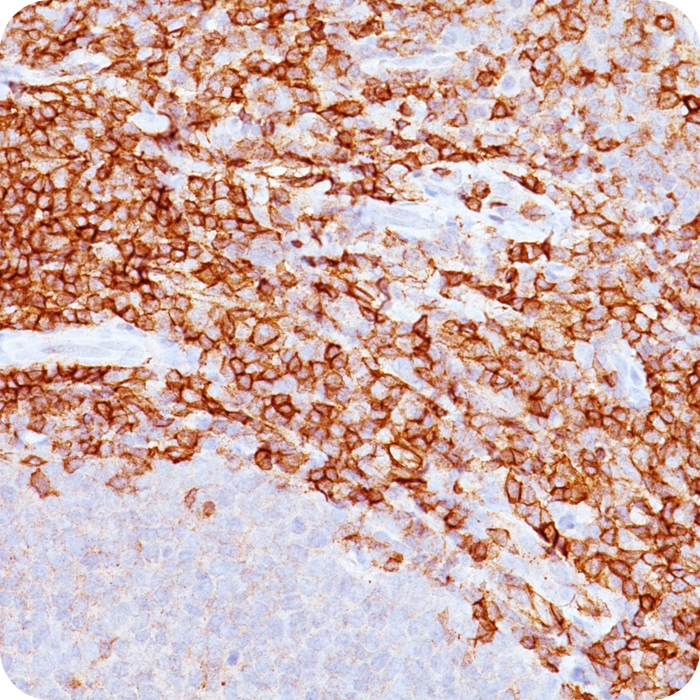 CD43 (T-Cell Marker); Clone DF-T1 (Concentrate)