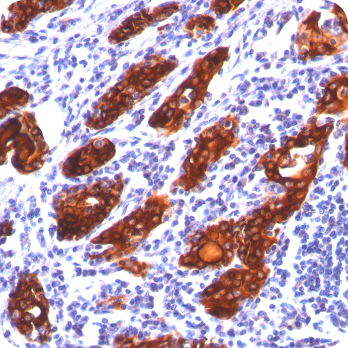 Thyroglobulin (Thyroidal Cell Marker); Clone 2H11 (Concentrate)