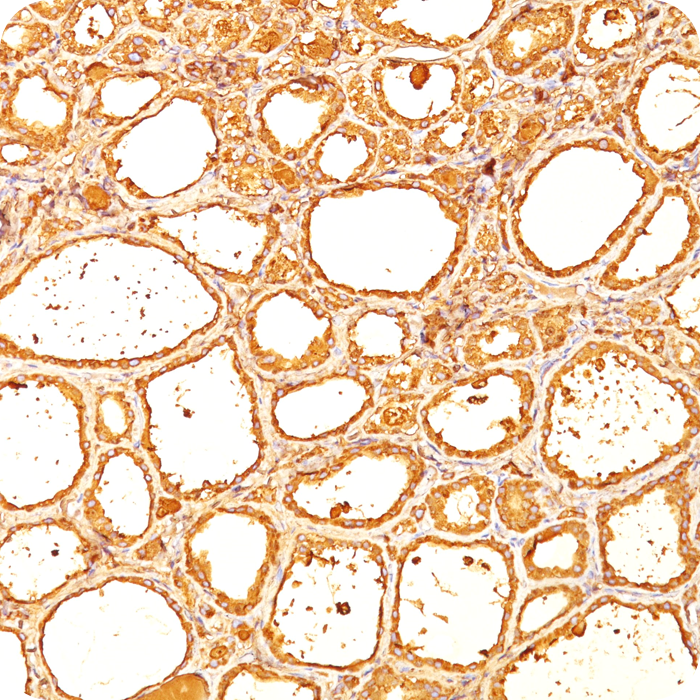 Thyroglobulin (Thyroidal Cell Marker); Clone TGB04 & TGB05 (Concentrate)