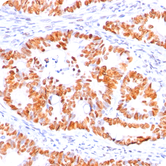 p53 Tumor Suppressor Protein; Clone BP53-12 (Concentrate)