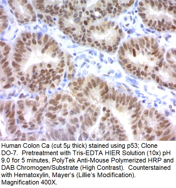 p53 Tumor Suppressor Protein; Clone DO-7 (Concentrate)