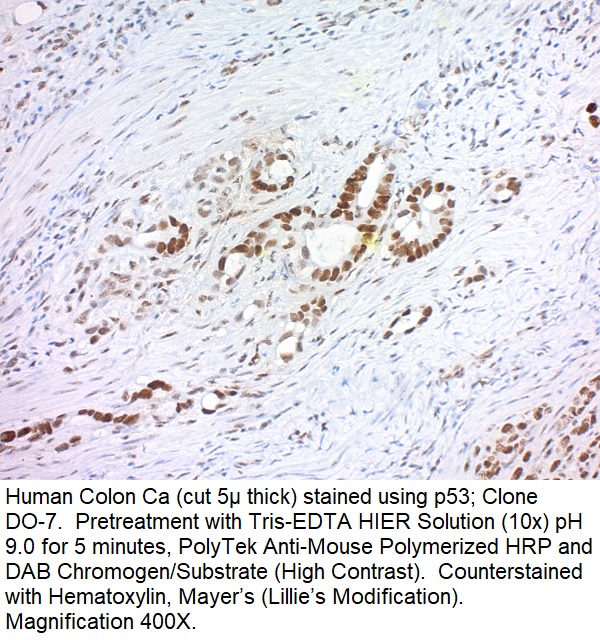 p53 Tumor Suppressor Protein; Clone DO-7 (Concentrate)