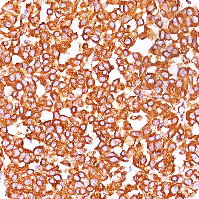 Vimentin (Mesenchymal Cell Marker); Clone VM452 (Concentrate)