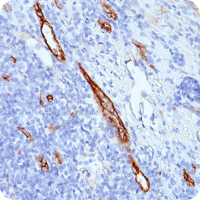 von Willebrand Factor / Factor VIII Related-Ag (Endothelial Marker); Clone VWF635 (Concentrate)