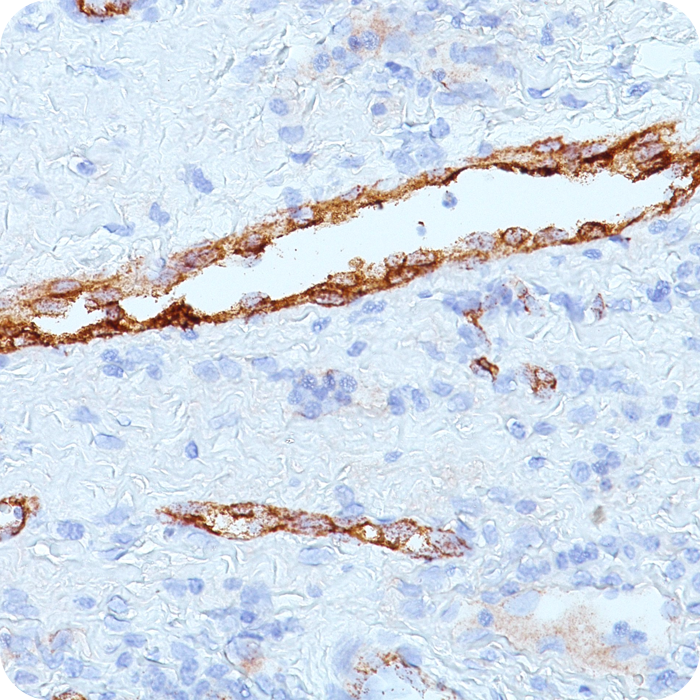 von Willebrand Factor / Factor VIII Related-Ag (Endothelial Marker); Clone 3E2D10 & VWF635 (Concentrate)