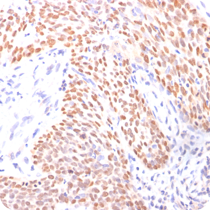 p40 (deltaNp63) (Squamous, Basal, or Myoepithelial Cell Marker); Rabbit Polyclonal (Concentrate)