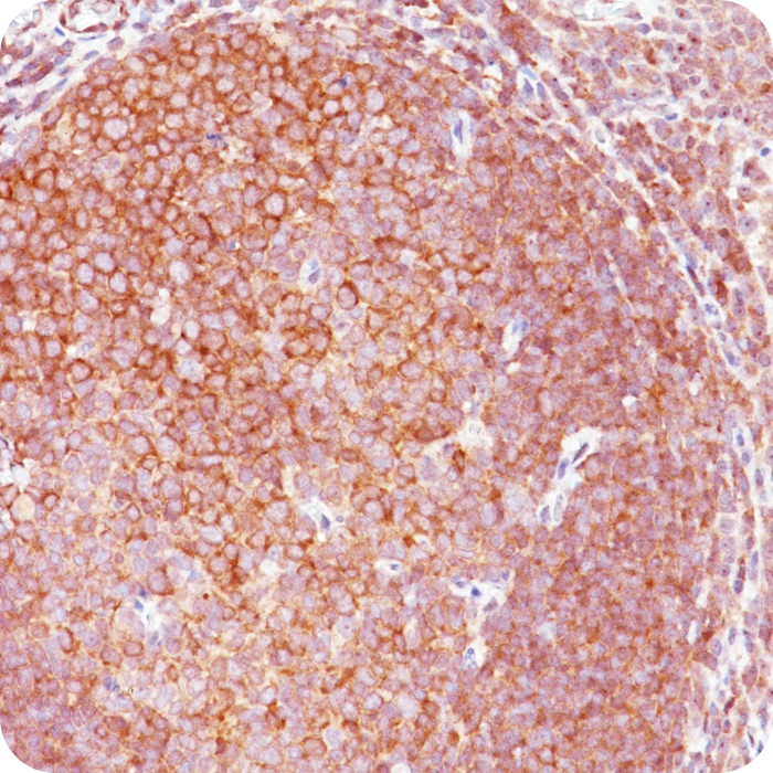 Napsin A (Lung Adenocarcinoma Marker); Rabbit Polyclonal (Concentrate)