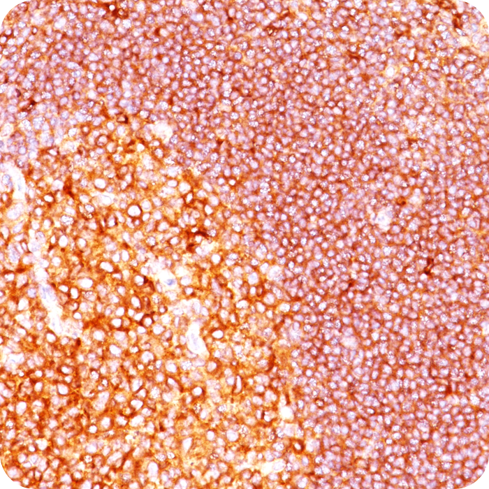 MALT1 (MALT-Lymphoma Marker); Clone MT1/410 (Concentrate)