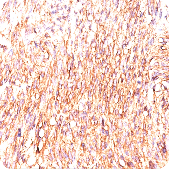 DOG-1 / TMEM16A (Marker for Gastrointestinal Stromal Tumors); Clone DG1/447 (Concentrate)