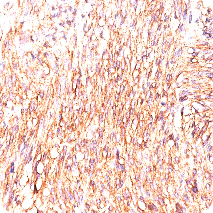 DOG-1 / TMEM16A (Marker for Gastrointestinal Stromal Tumors); Clone DOG-1.1 (Concentrate)