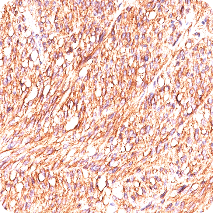 DOG-1 / TMEM16A (Marker for Gastrointestinal Stromal Tumors); Clone DG1/447 & DOG-1.1 (Concentrate)