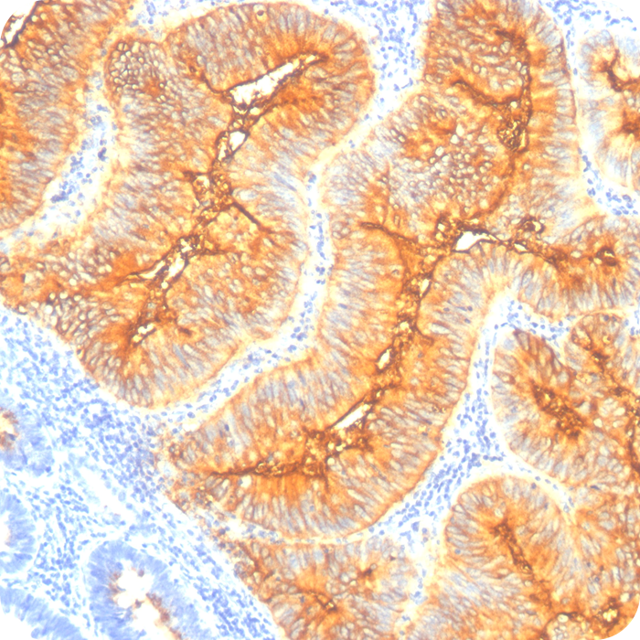 TAG-72 (Tumor-Associated Glycoprotein); Clone B72.3 (Concentrate)