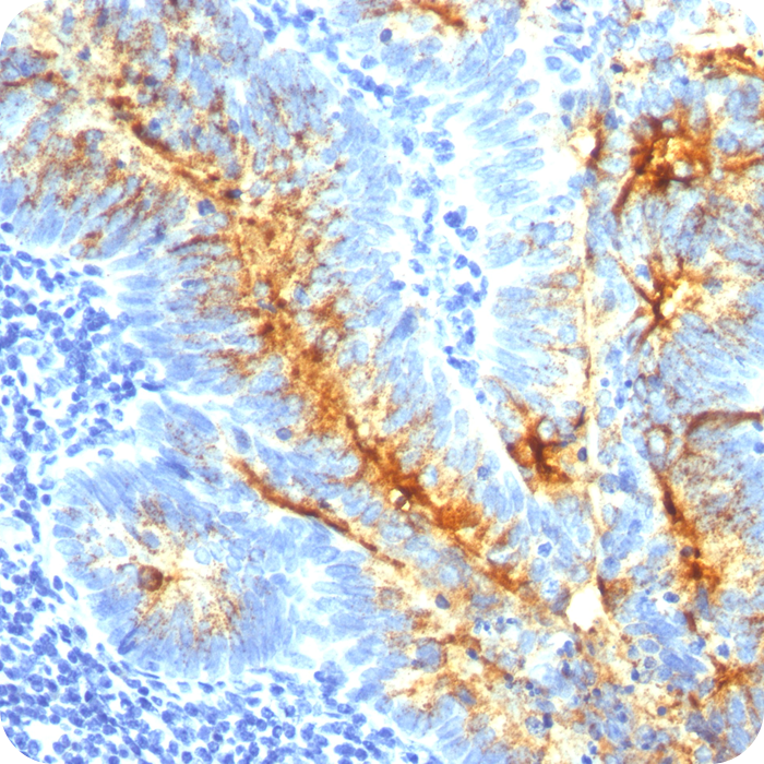 TAG-72 (Tumor-Associated Glycoprotein); Clone CC49 (Concentrate)