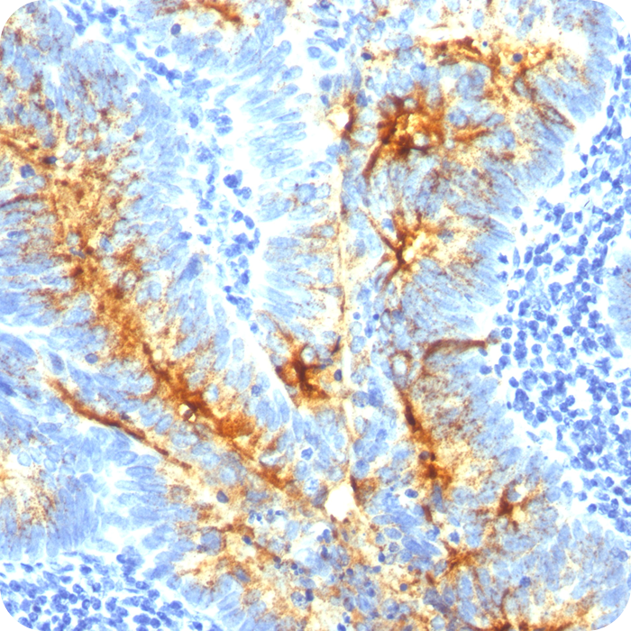 TAG-72 (Tumor-Associated Glycoprotein); Clone CA72/733 (Concentrate)