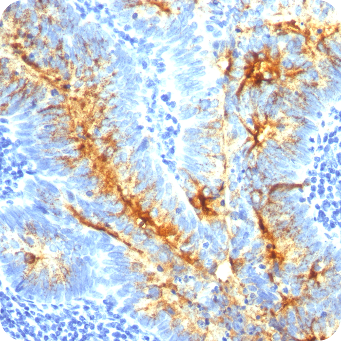 TAG-72 (Tumor-Associated Glycoprotein); Clone B72.3 & CA72/733 (Concentrate)