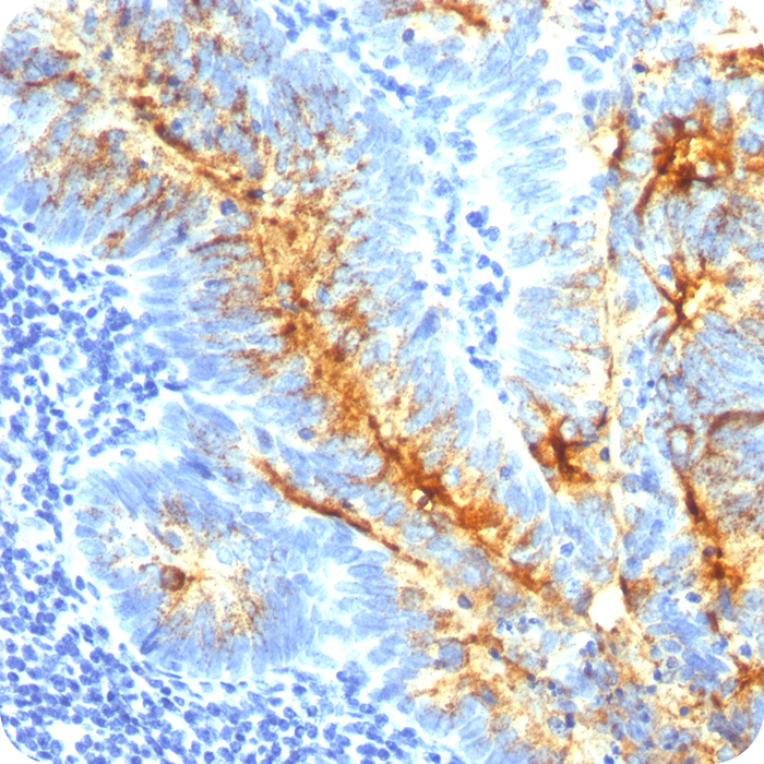 TAG-72 (Tumor-Associated Glycoprotein); Clone B72.3 & CC49 (Concentrate)