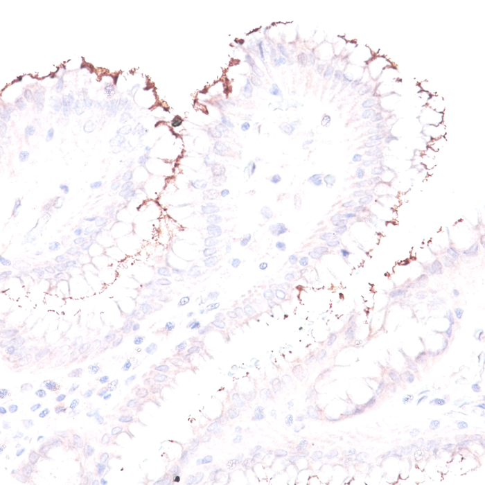 Helicobacter Pylori; Rabbit Polyclonal (Concentrate)