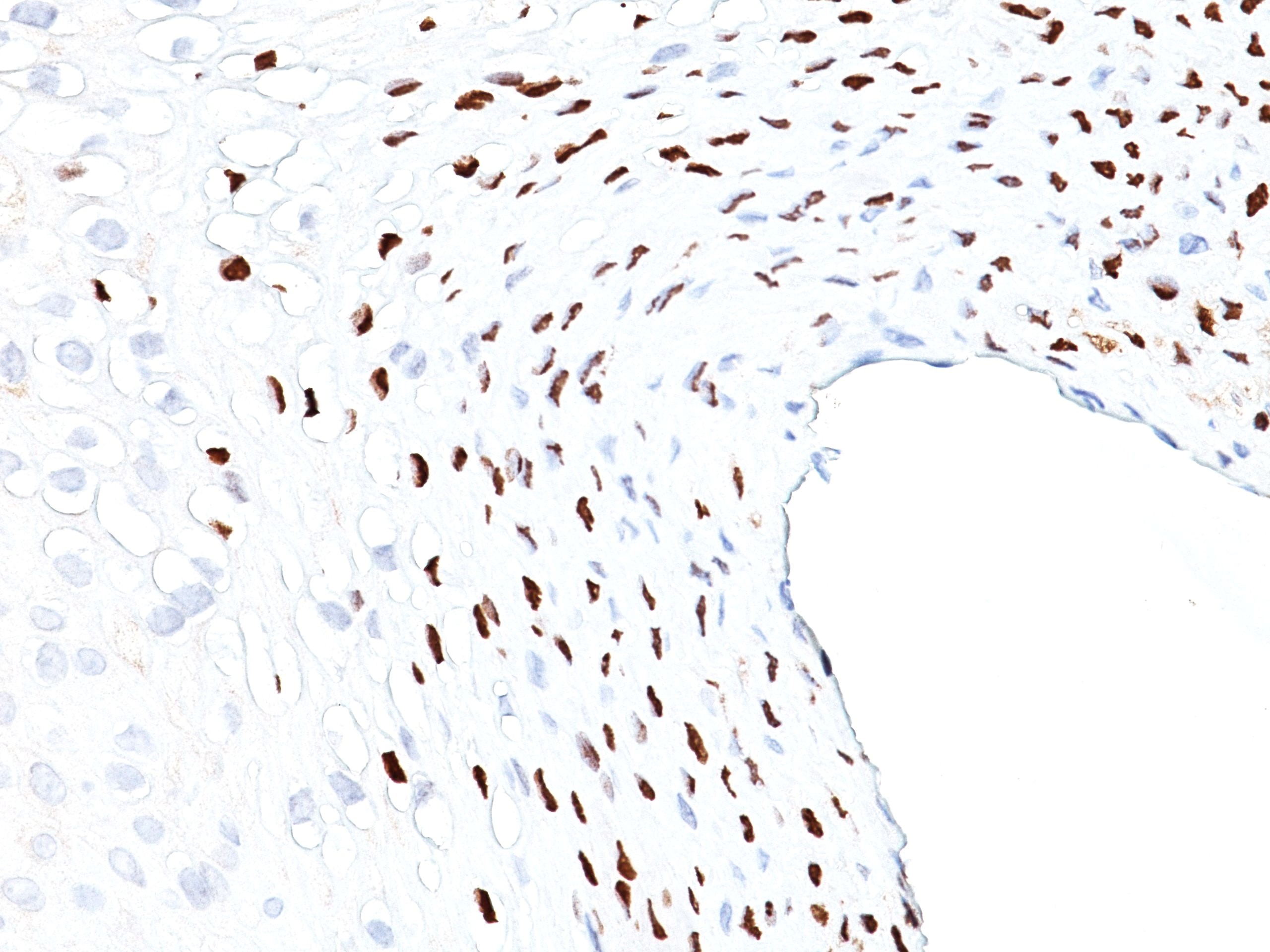 HPV-16 (Human Papilloma Virus 16); Clone CAMVIR-1 (Concentrate)