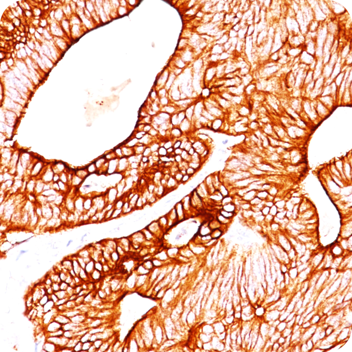 Cytokeratin 8/18 (Epithelial Marker); Clone K8.8 & DC10 (Concentrate)
