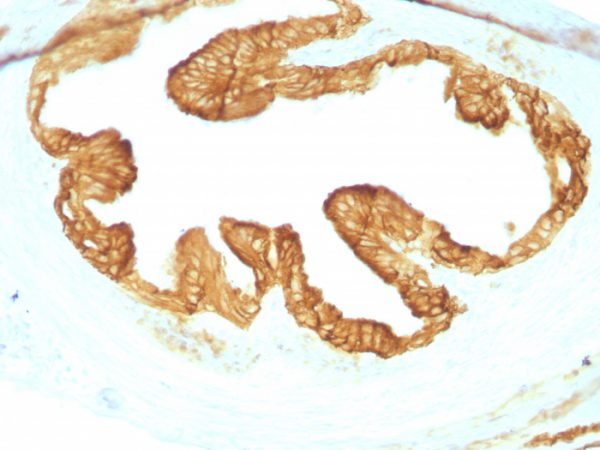 Cytokeratin, Pan (Epithelial Marker); Clone KRTL/1077 + KRTH/1076 (Concentrate)