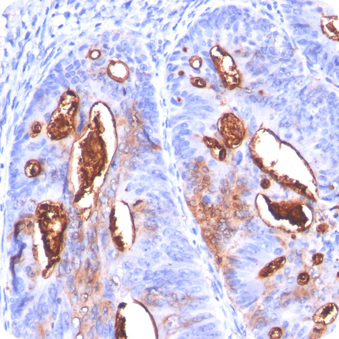 CA19-9/Sialyl Lewisa (GI Tumor Marker); Clone 121SLE (Concentrate)