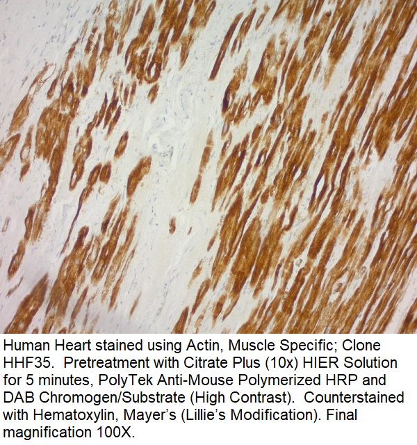 Actin, Muscle Specific (Muscle Cell Marker); Clone HHF35 (Concentrate)