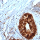 Beta-2 Microglobulin (Renal Failure & Tumor Marker); Clone B2M/961 (Concentrate)