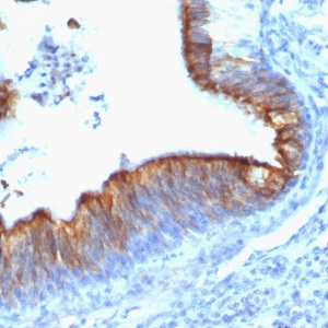 Cytokeratin 8; Clone KRT8/899 (Concentrate)