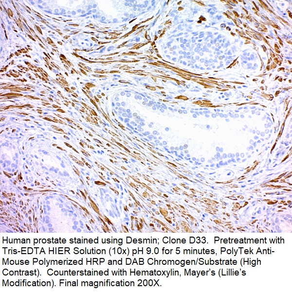 Desmin (Muscle Cell Marker); Clone D33 (Concentrate)
