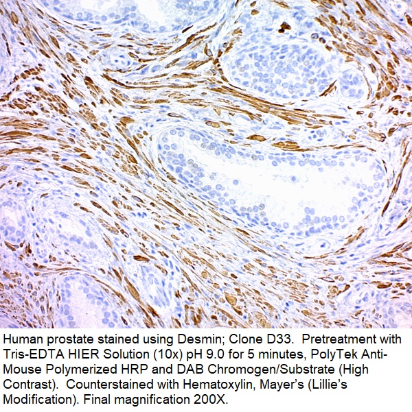 Desmin (Muscle Cell Marker); Clone D33 (Concentrate)