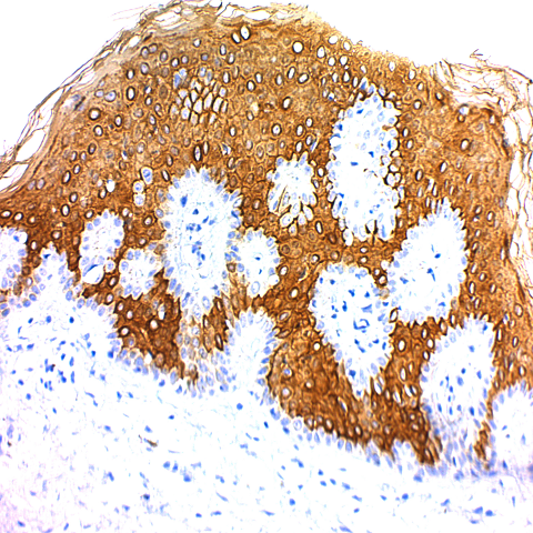 Cytokeratin 10 (Suprabasal Epithelial Marker); Clone DE-K10 (Concentrate)