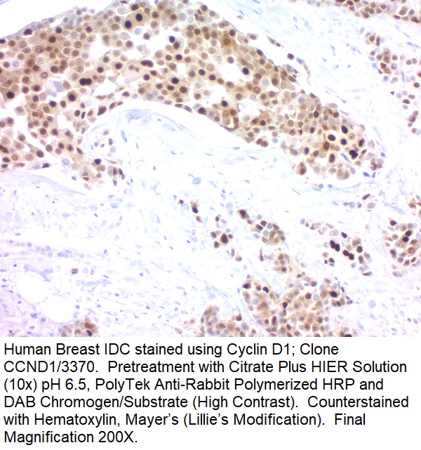 Cyclin D1 (G1-Cyclin & Mantle Cell Lymphoma Marker); Clone CCND1/3370 (Concentrate)