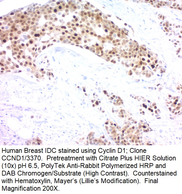 Cyclin D1 (G1-Cyclin & Mantle Cell Lymphoma Marker); Clone CCND1/3370R (Concentrate)