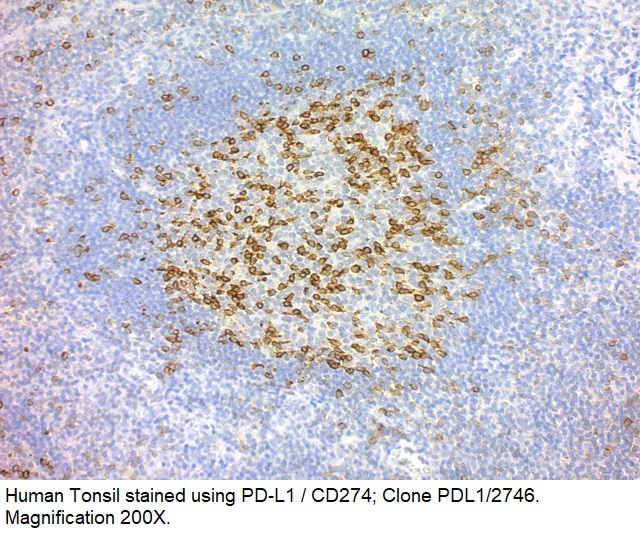 PD-L1 / PDCD1LG1 / CD274 / B7-H1; Clone PDL1/2746 (Concentrate)