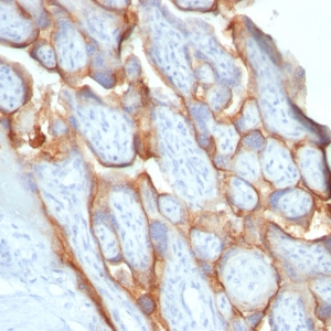 HCG-beta (Pregnancy & Choriocarcinoma Marker); Clone SPM529 (Concentrate)