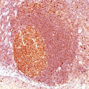 MALT1 (MALT-Lymphoma Marker); Clone SPM578 (Concentrate)