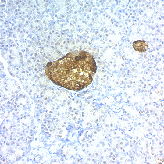 Chromogranin A / CHGA (Neuroendocrine Marker); Clone SPM553 (Concentrate)