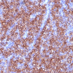 Chromogranin A / CHGA (Neuroendocrine Marker); Clone CGA/413 (Concentrate)
