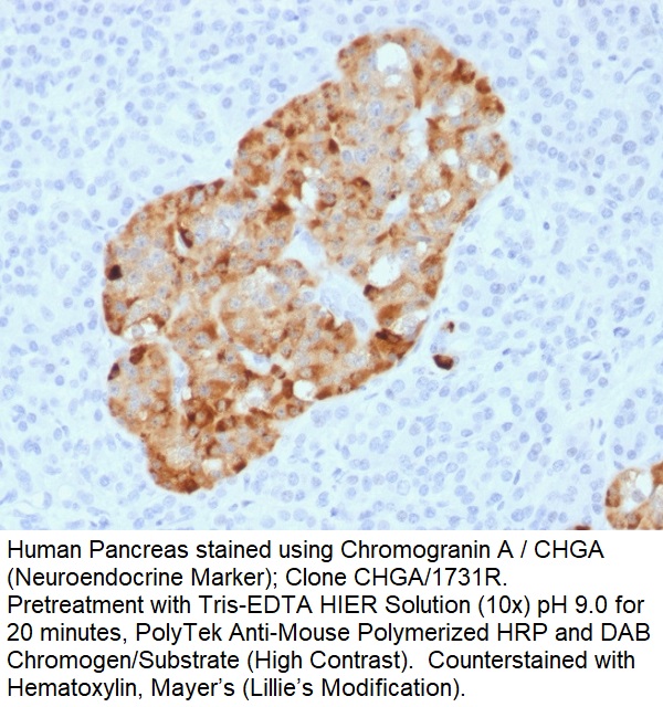 Chromogranin A / CHGA (Neuroendocrine Marker); Clone CHGA/1731R (Concentrate)