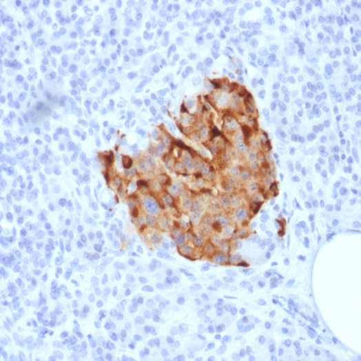 Chromogranin A / CHGA (Neuroendocrine Marker); Clone CHGA/1773R (Concentrate)